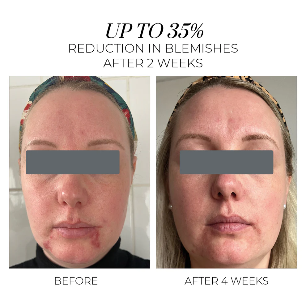 Oskia Violet Water Clearing Cleanser